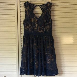 Francesca’s Lace Dress